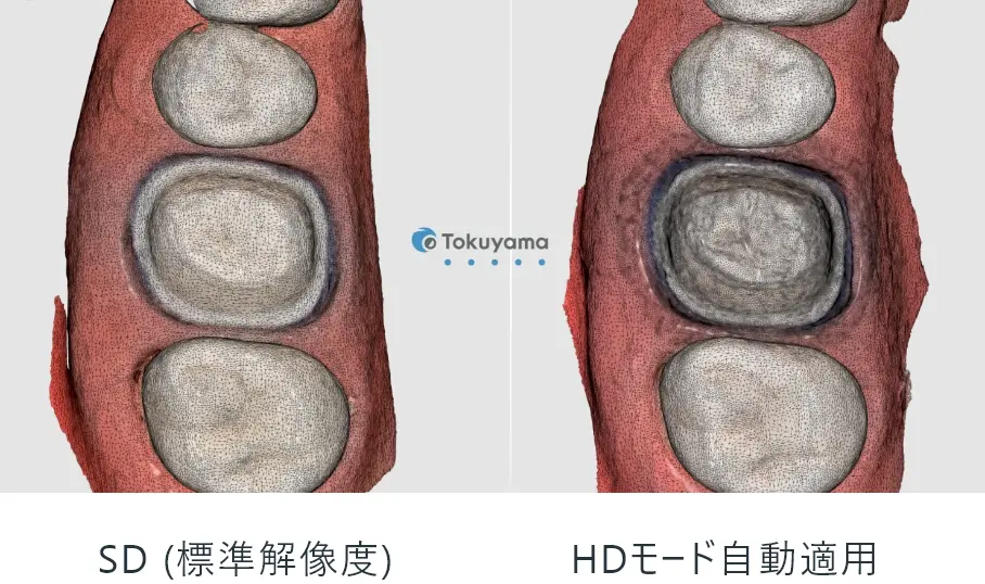 SD (標準解像度) HDモード自動適用