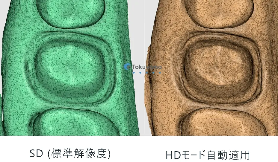 SD (標準解像度) HDモード自動適用