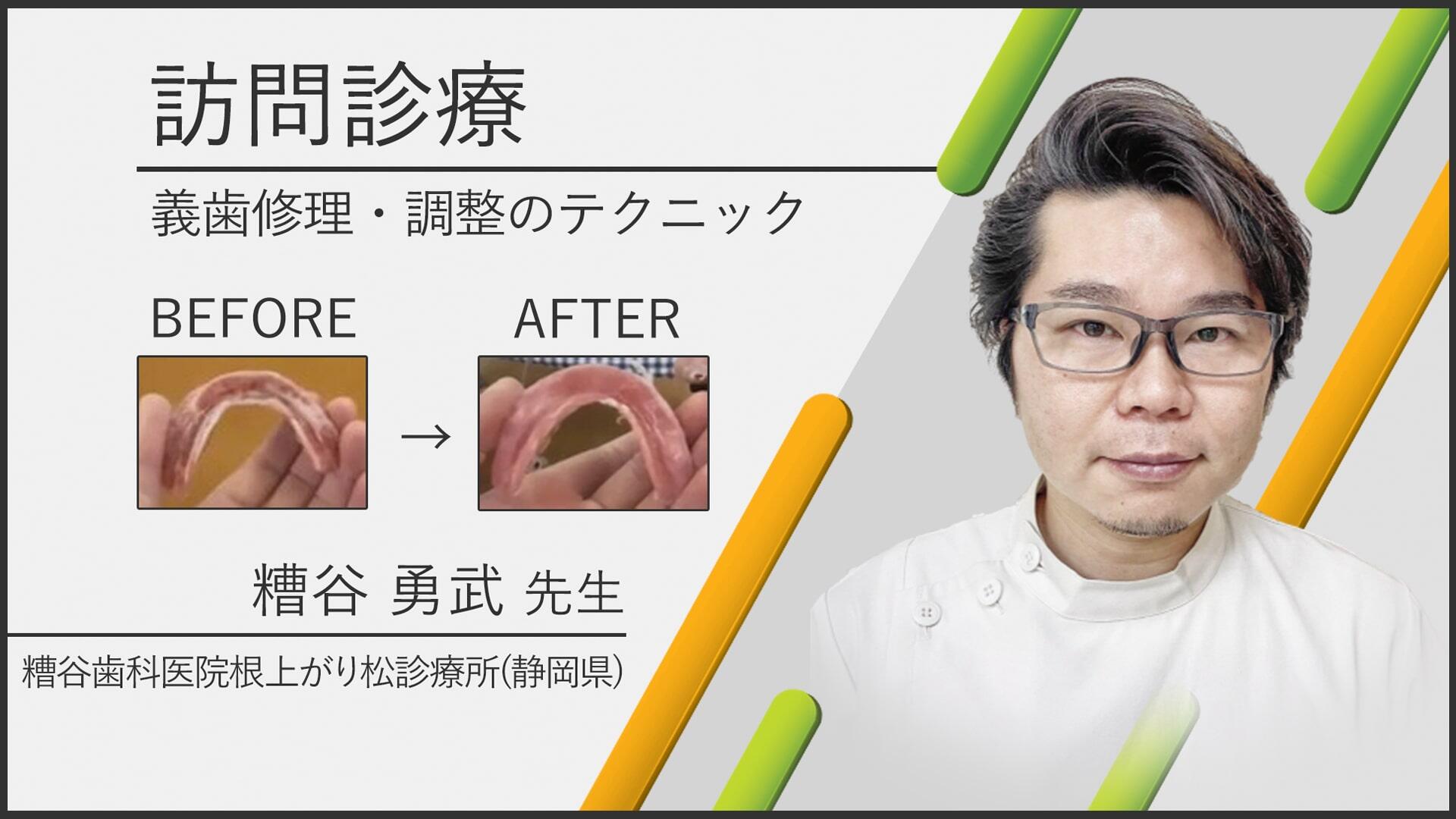 訪問診療　義歯修理・調整のテクニック　サムネイル糟谷先生.jpg