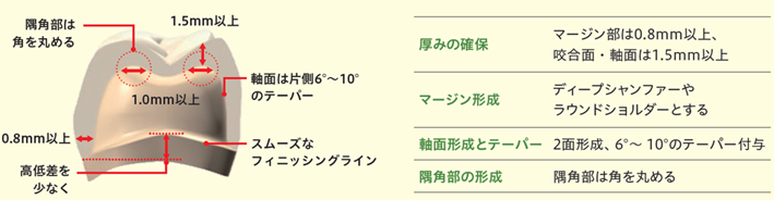 支台歯形成のポイント.png